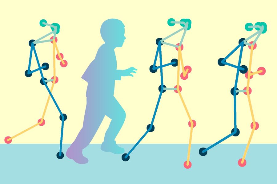 MIT looks to improve the quality of life for cerebral palsy patients using a pose-mapping technique