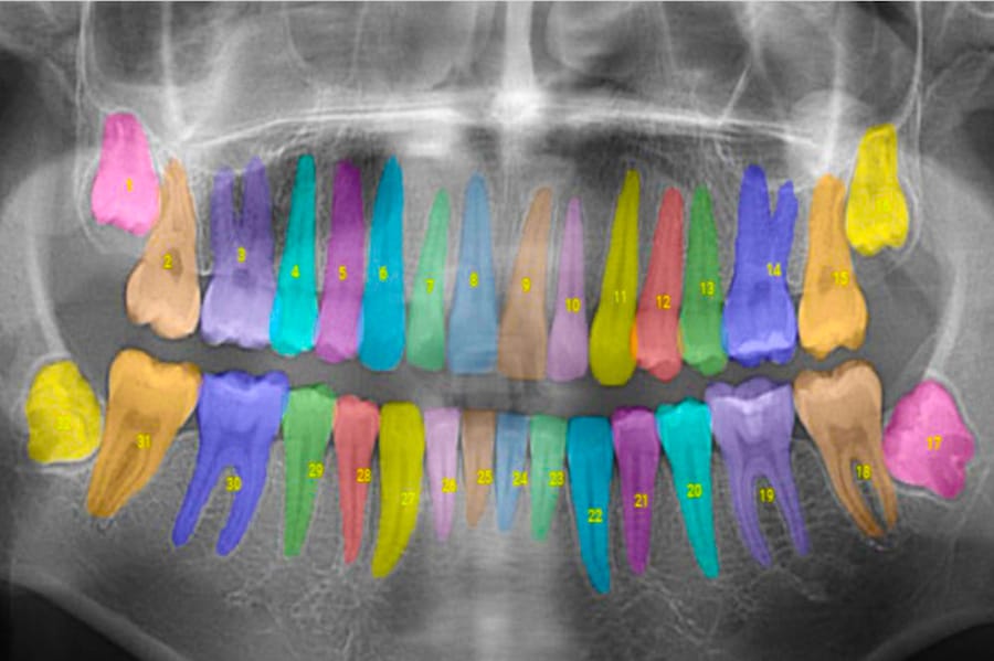 AI-assisted dental treatment post image