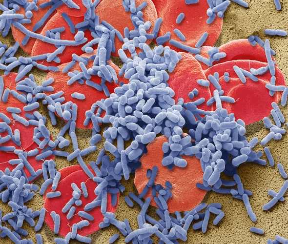 An algorithm that detects sepsis reduces deaths by nearly 20 percent