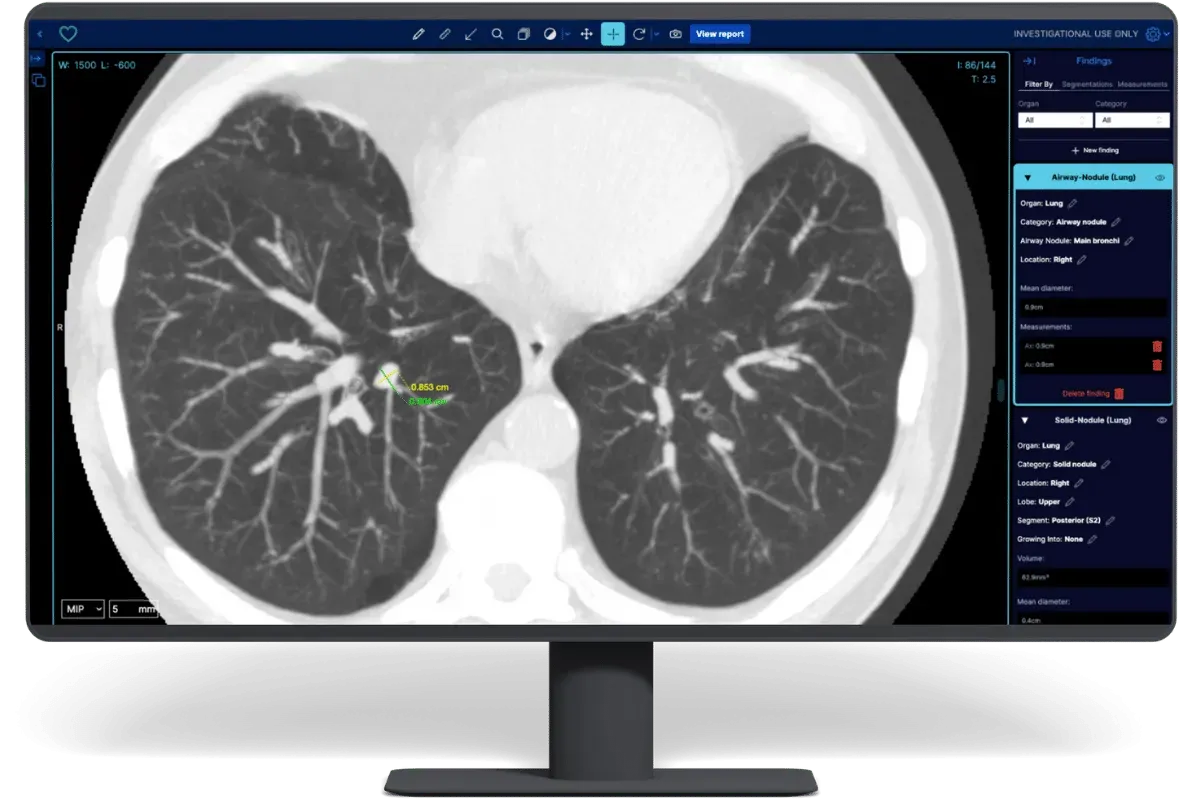Estonia-based Better Medicine raises €1M for its AI-powered detection tool for kidney cancer