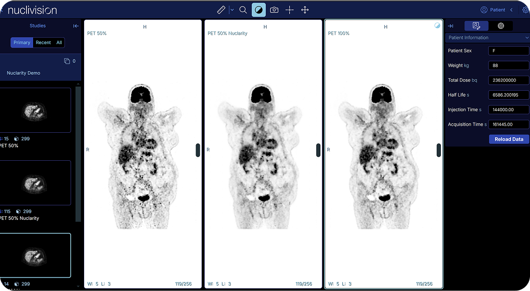 AI-enhanced medical imaging startup Nuclivision secures €5M seed funding Post feature image