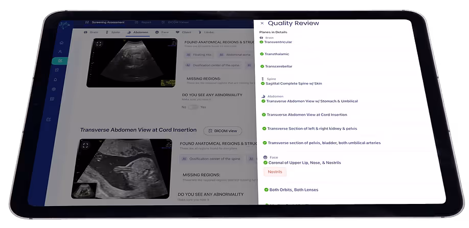 BioticsAI's AI-powered fetal abnormality detection software has been cleared by the FDA Post feature image