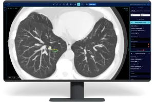 Estonia-based Better Medicine raises €1M for its AI-powered detection tool for kidney cancer feature image