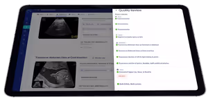 BioticsAI's AI-powered fetal abnormality detection software has been cleared by the FDA